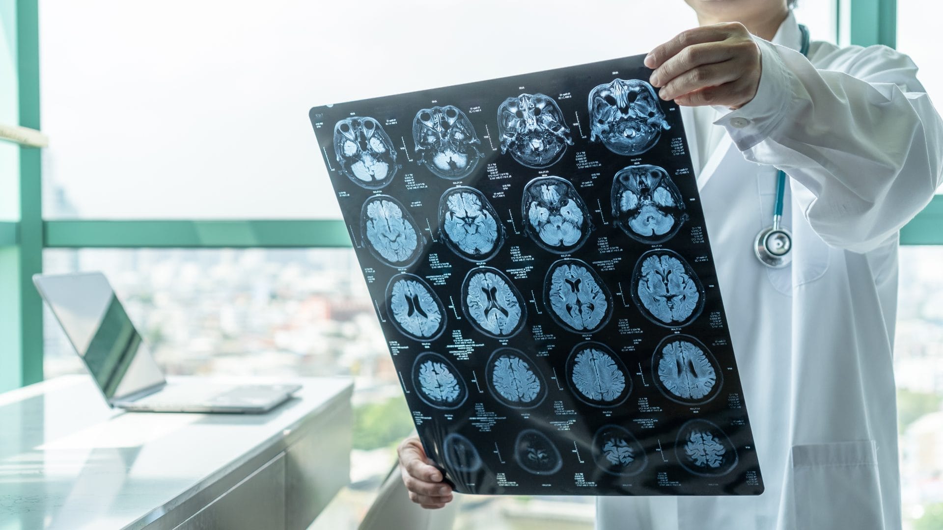 Climate Change and Brain Health Study Reveals Alarming Connections – One Green Planet - Vimarsana News